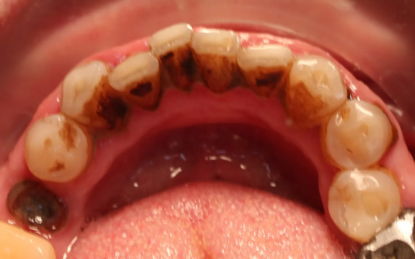 ملاحظات پس از جرمگیری
